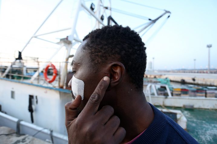 Ožiljak pokraj uha – Rives Miller Djiofack Neguensi / Foto F. ŠIMIČEV